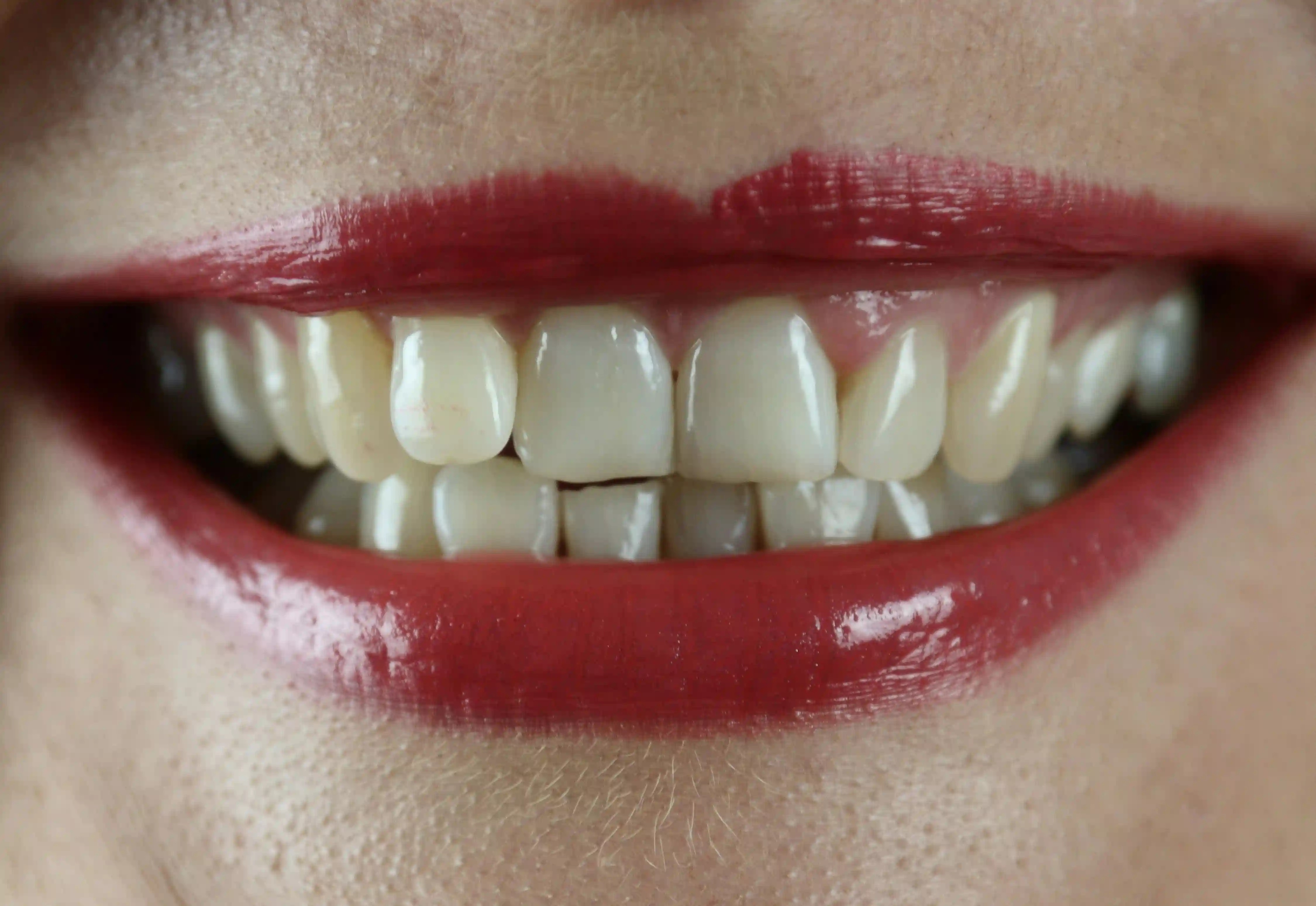 Raudonomis lūpomis padažytos moters šypsena, pro kurią matomi dantys